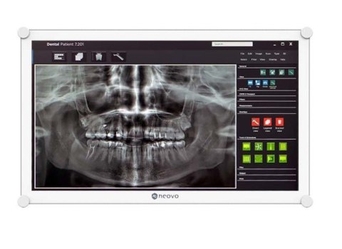 Monitor AG NEOVO DR-2202 21.5 FHD dentystyczny z DICOM IP65